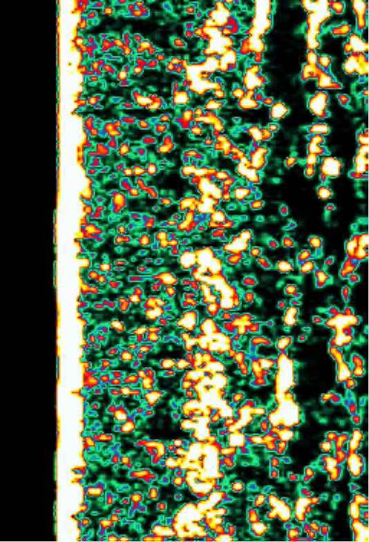 Skin scan showing improved collagen structure month three