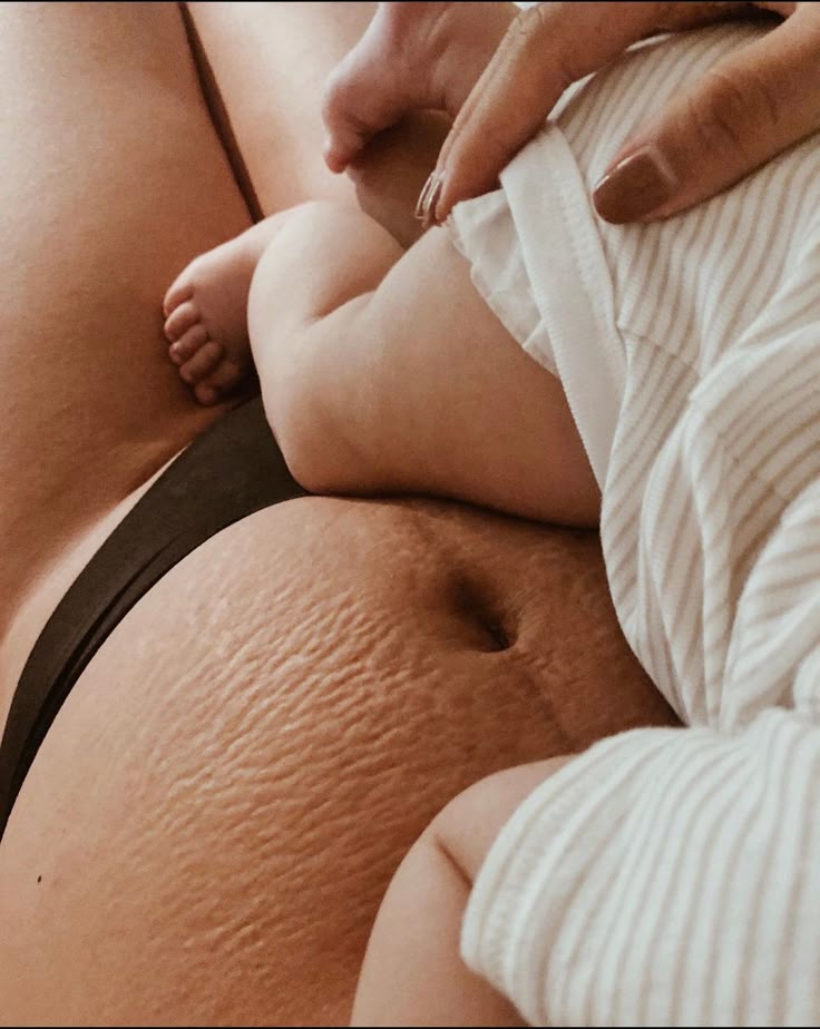 Postpartum mum with stretch marks holding newborn